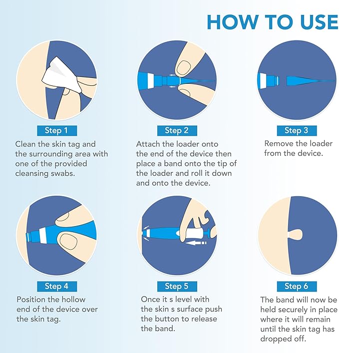 TagBand Micro Deluxe Remover